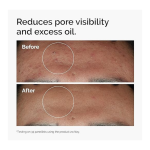 The Ordinary Niacinamide 10% + Zinc 1% 30ml - Image 2